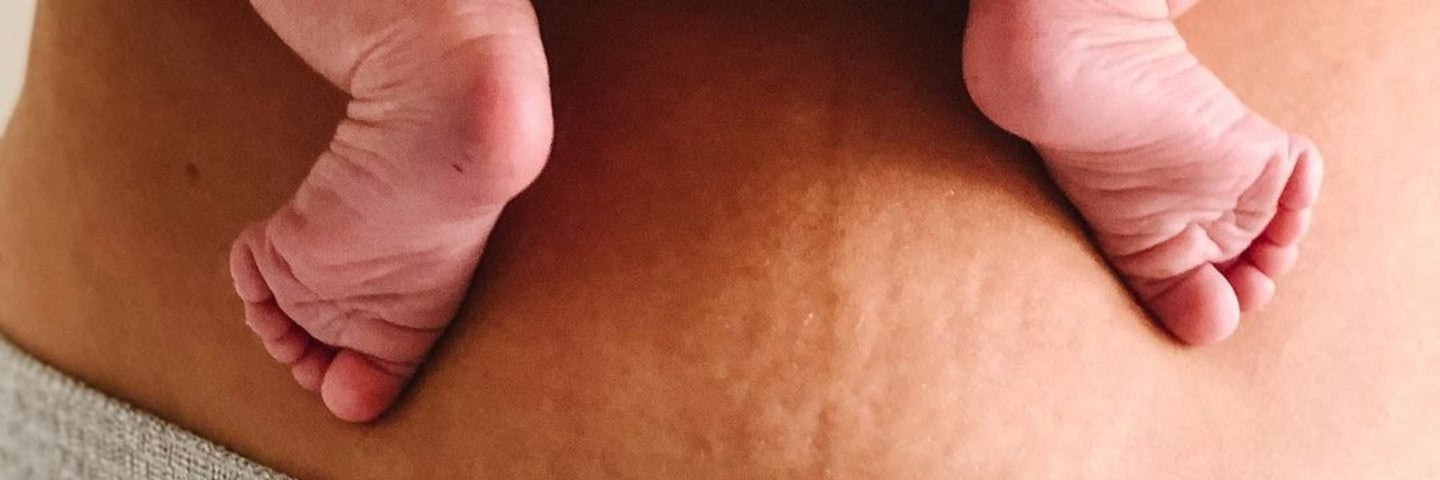 Comment se sortir de la dépression post-partum ?
