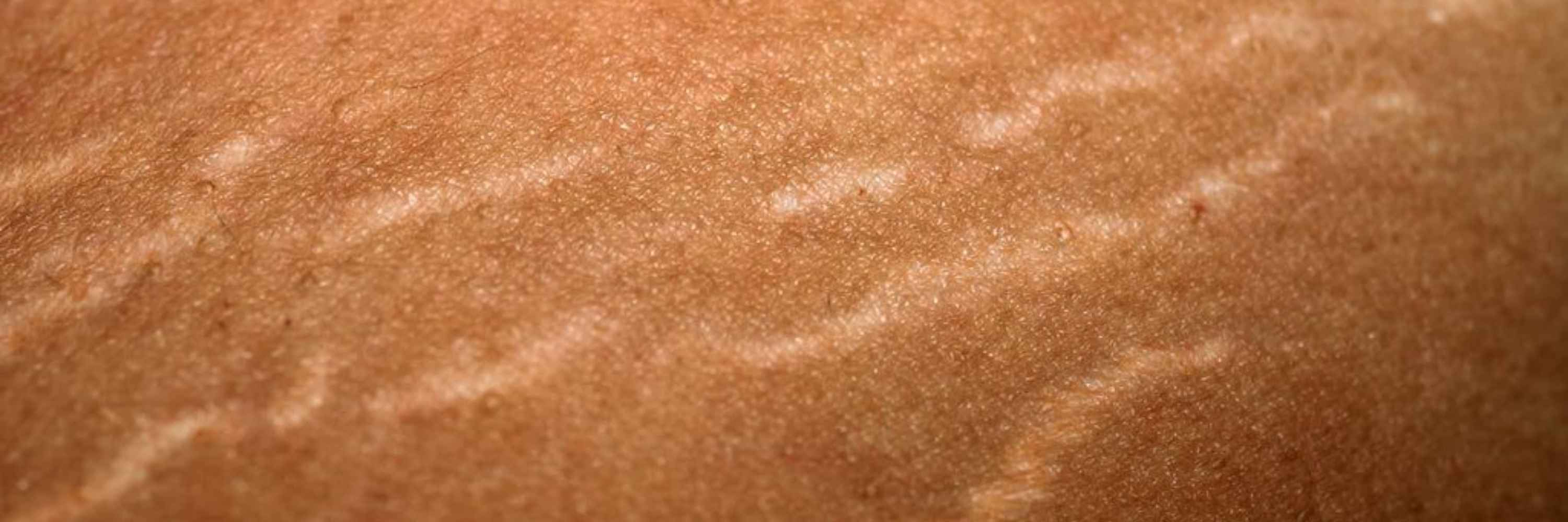 Comment la grossesse et l’accouchement transforment le corps ?