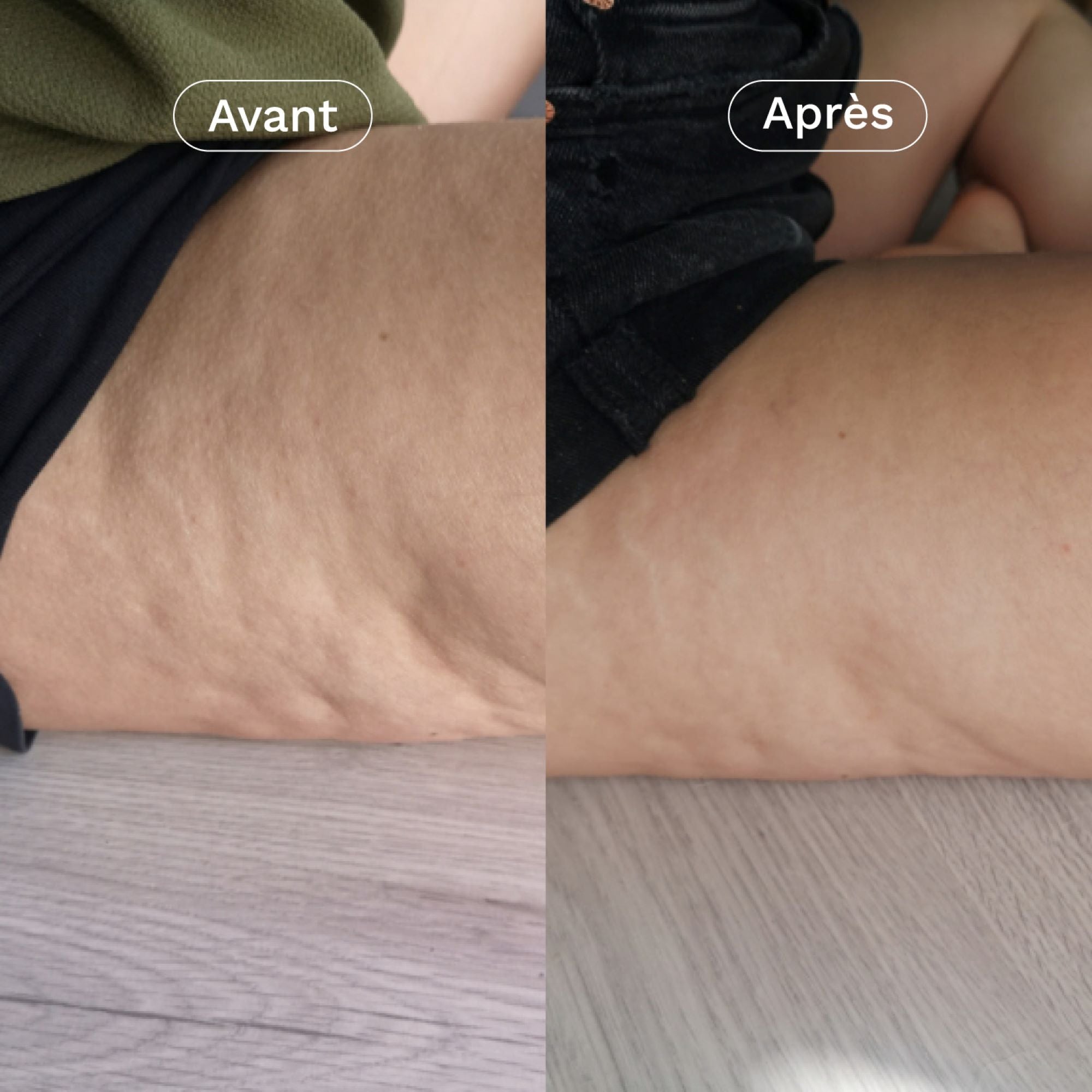 Compléments alimentaires minceur 3-en-1 - Omum