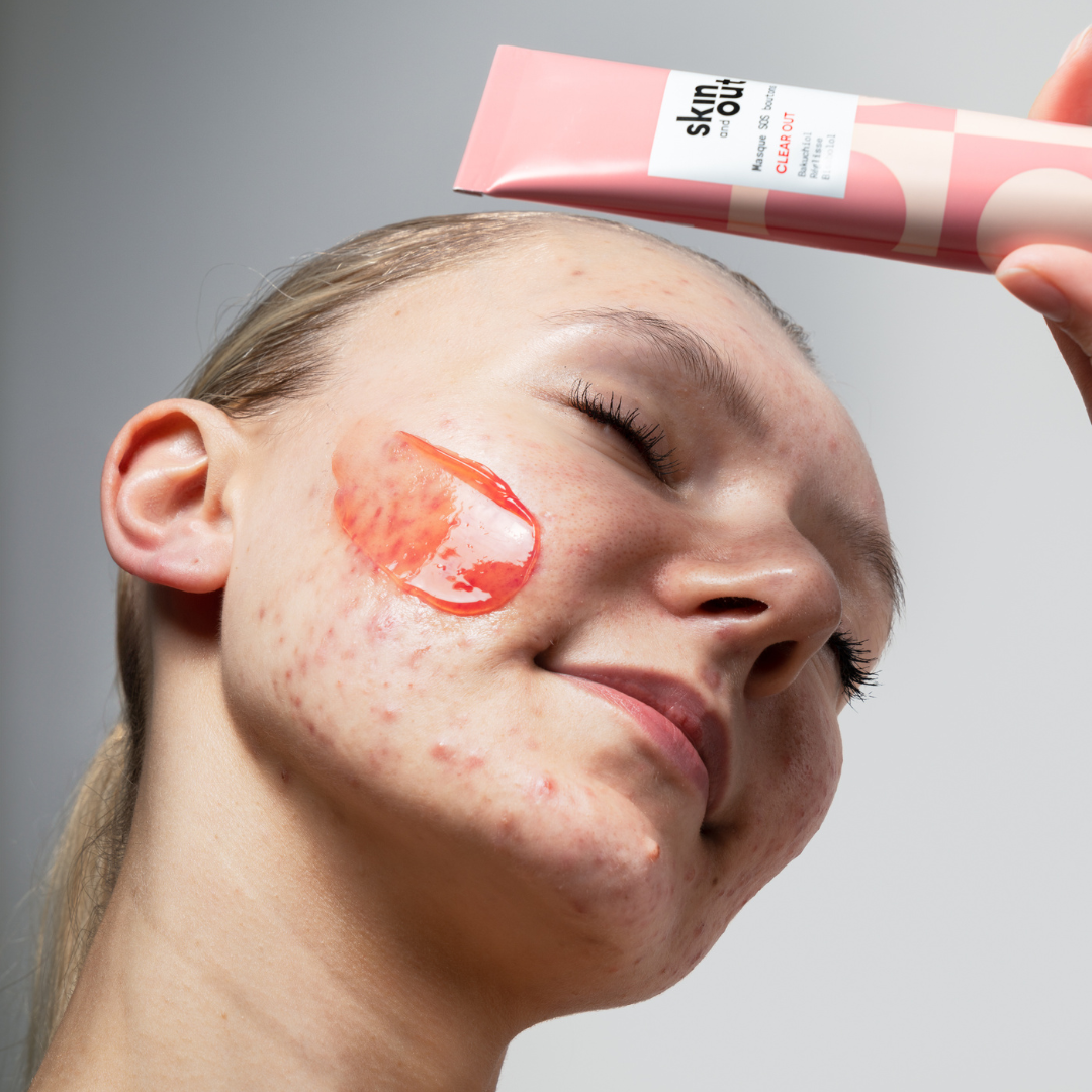 Clear Out - Masque apaisant pour les boutons - SKIN & OUT