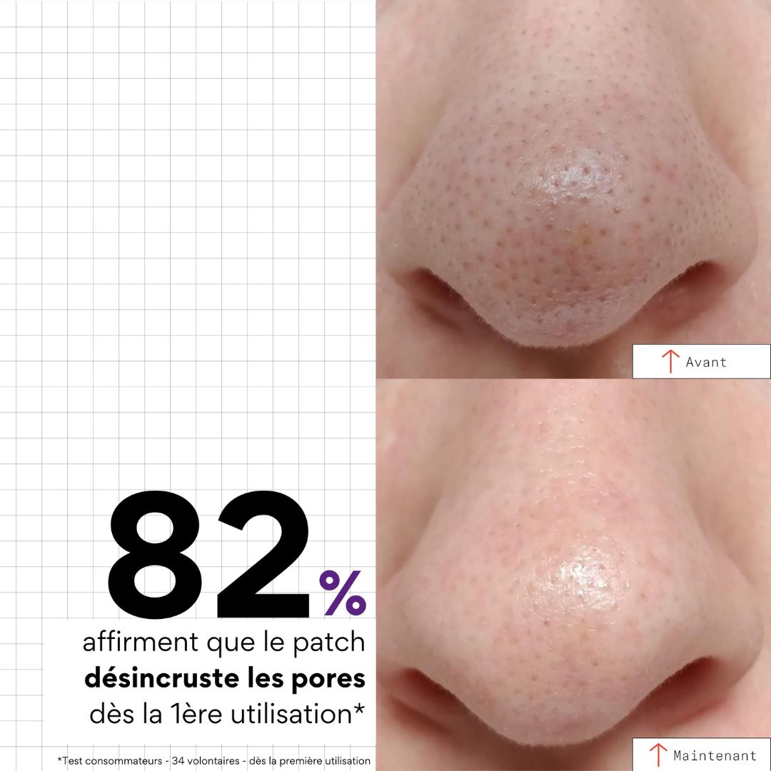 Peel Out - Patchs nez purifiant x5 - SKIN & OUT
