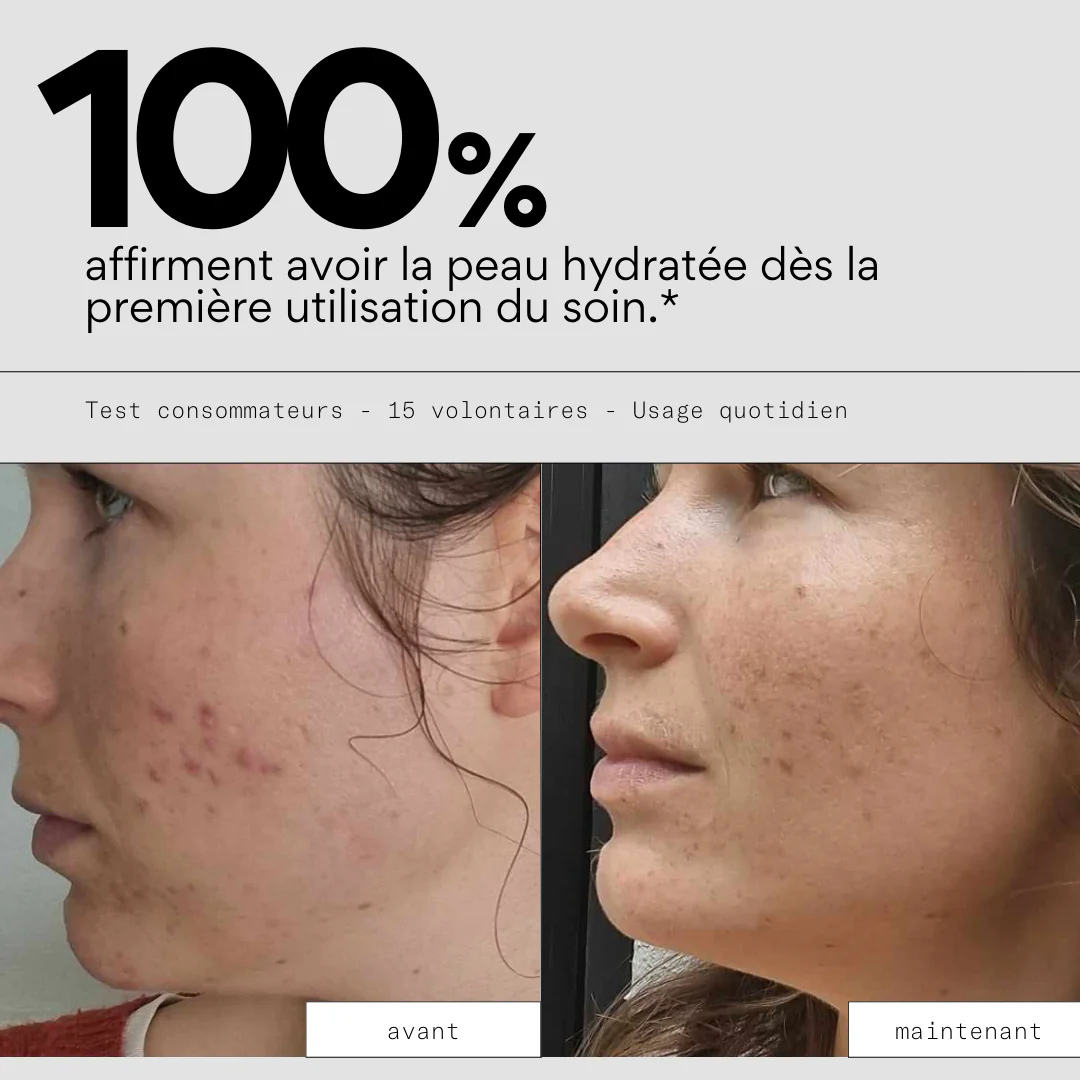 Feed Out - Crème hydratante pour les imperfections - SKIN & OUT