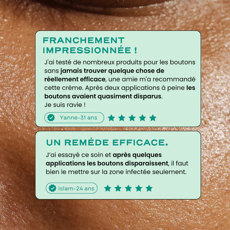 Crème visage anti-acné cicatrice - Neat Circles