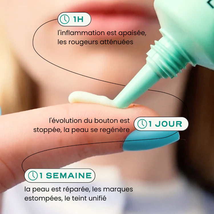 Crème visage anti-acné cicatrice - Neat Circles