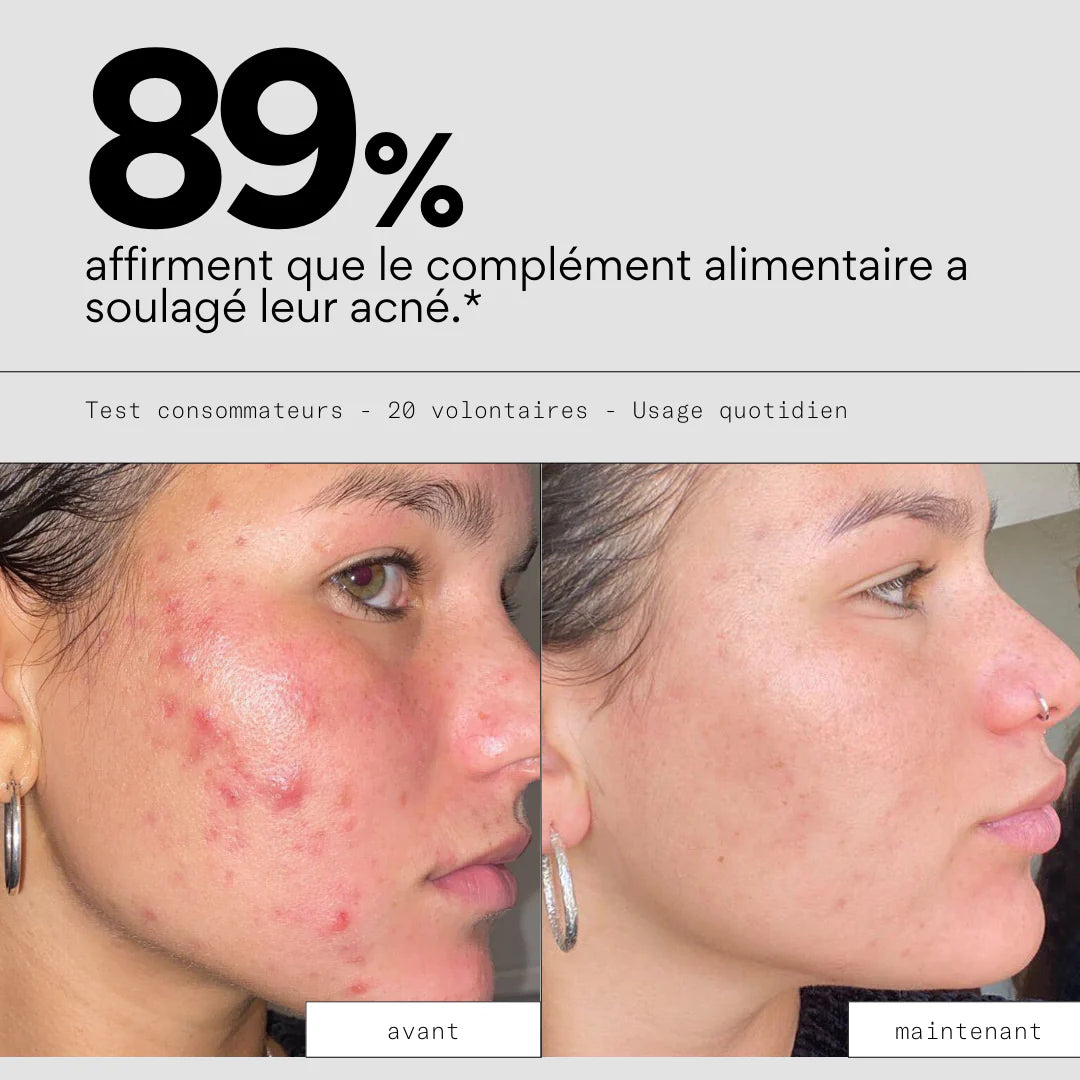 Clean In - Complément alimentaire cure anti-imperfections - SKIN & OUT