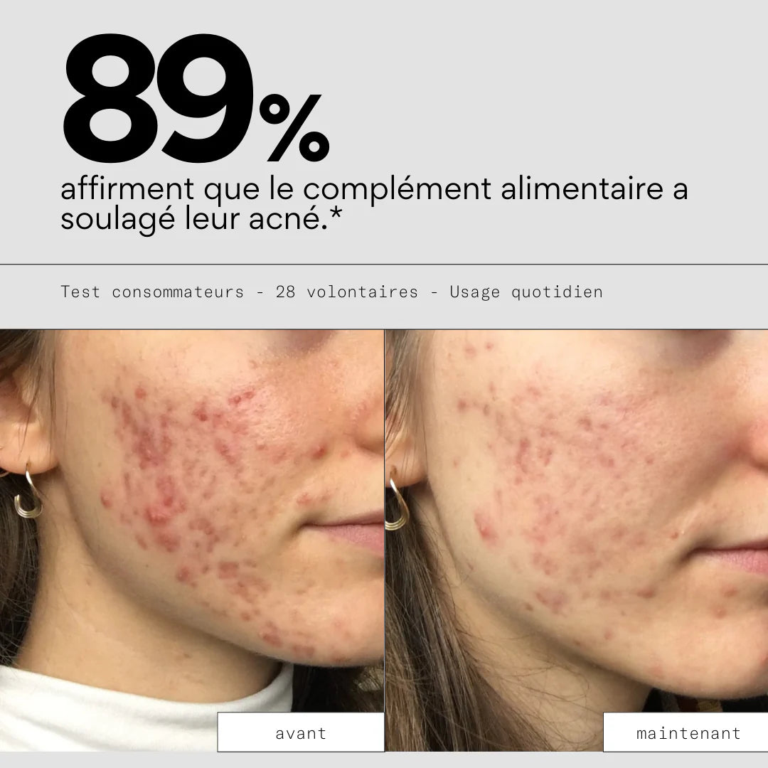 Clear In - Complément alimentaire anti-boutons - SKIN & OUT