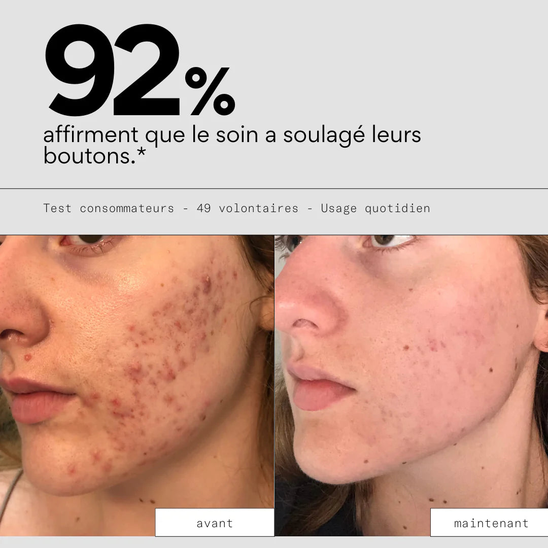 Clear Out - Soin anti-boutons aux prébiotiques - SKIN & OUT