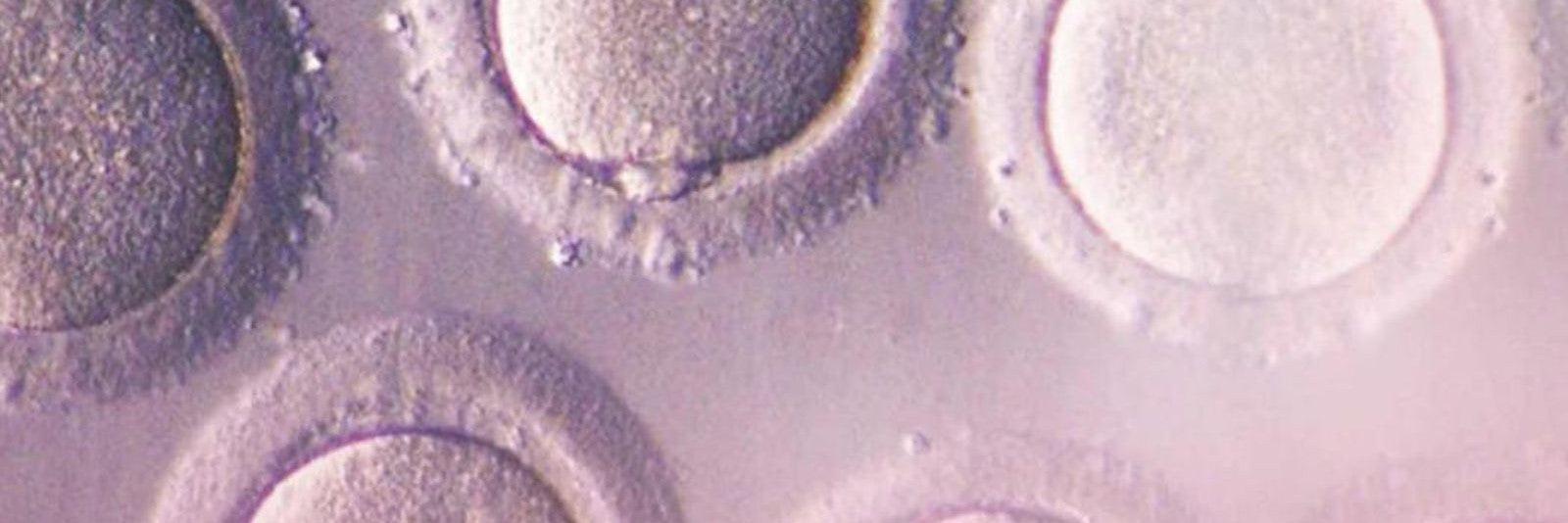 Vue au microscope d'ovocytes féminins