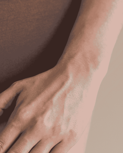 varices vulvaires pendant la grossesse, ventre d'une femme