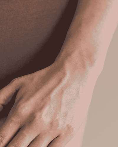 varices vulvaires pendant la grossesse, ventre d'une femme