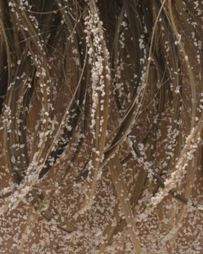 Reconnaître les symptômes prémenstruels et les soigner