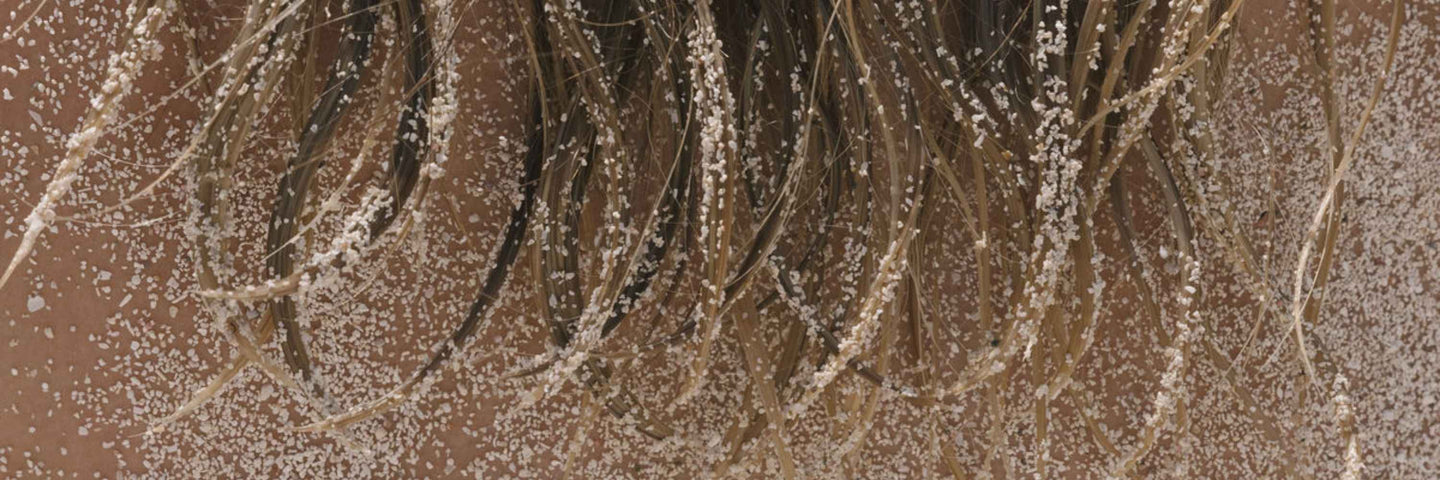 Reconnaître les symptômes prémenstruels et les soigner