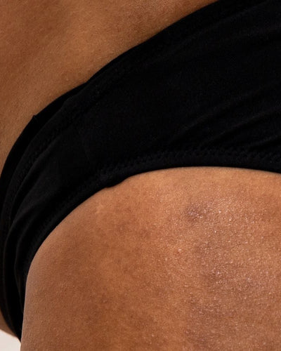 Allergique aux serviettes hygiéniques : pourquoi et que faire ?-Gapianne