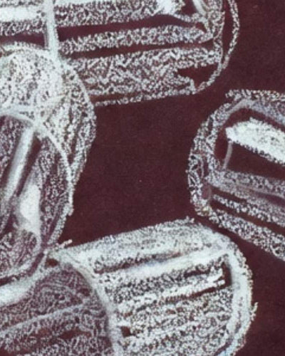 Help! J’ai des vaginoses à répétition : pourquoi et comment faire ?