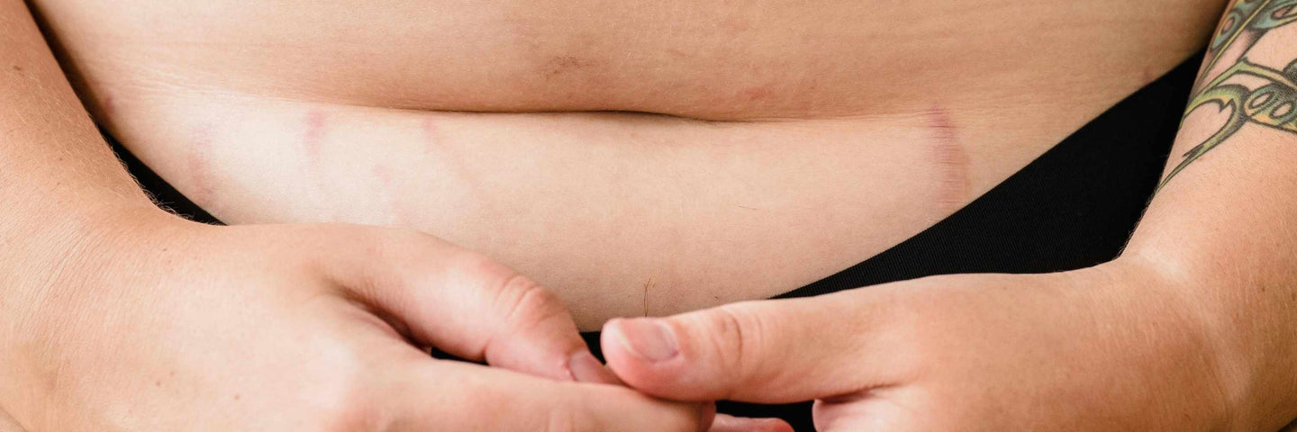 Pourquoi avez-vous des cycles menstruels longs et que faire ?