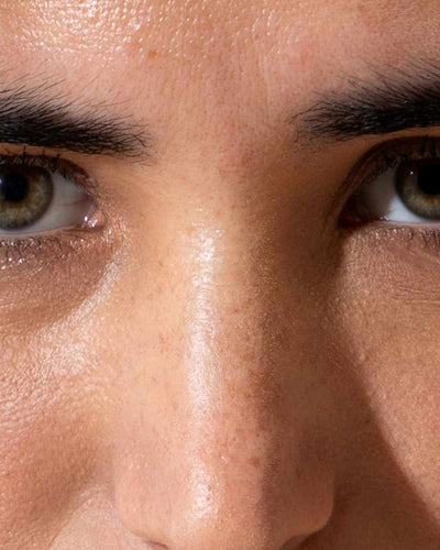 Dérèglement hormonal chez les femmes : causes, symptômes et solutions