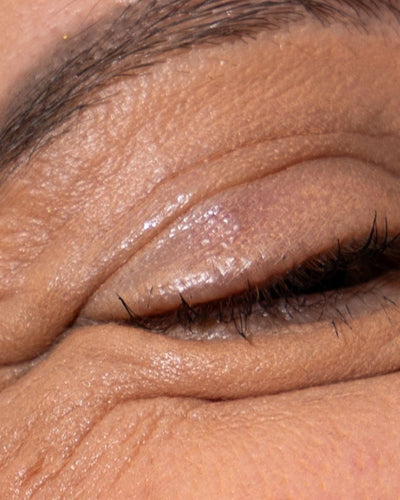 Quels sont les douleurs et symptômes liés à la ménopause ?