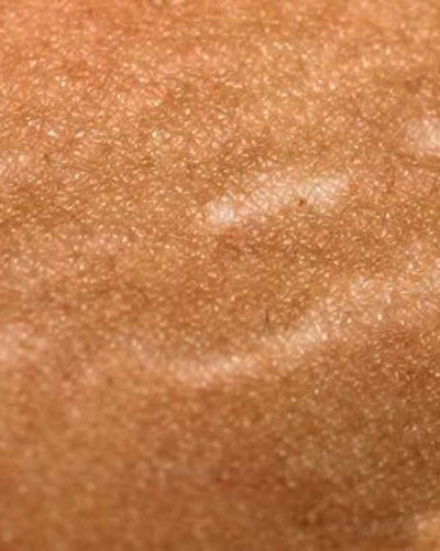 Comment la grossesse et l’accouchement transforment le corps ?