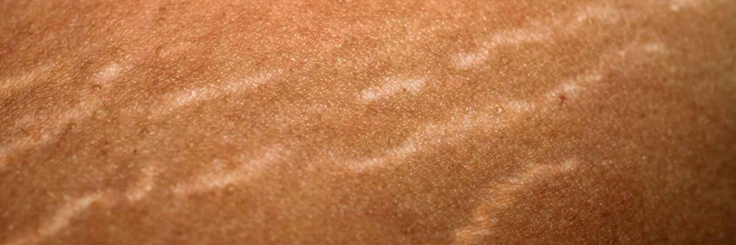 Comment la grossesse et l’accouchement transforment le corps ?