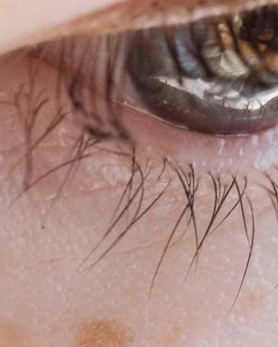 Le masque de grossesse : ce qu’il faut savoir-Gapianne