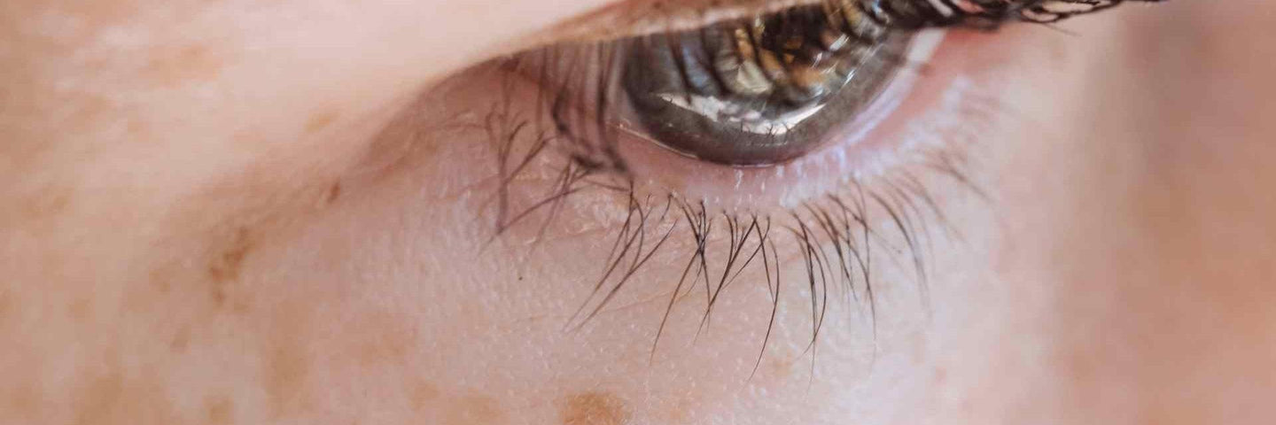 Le masque de grossesse : ce qu’il faut savoir-Gapianne