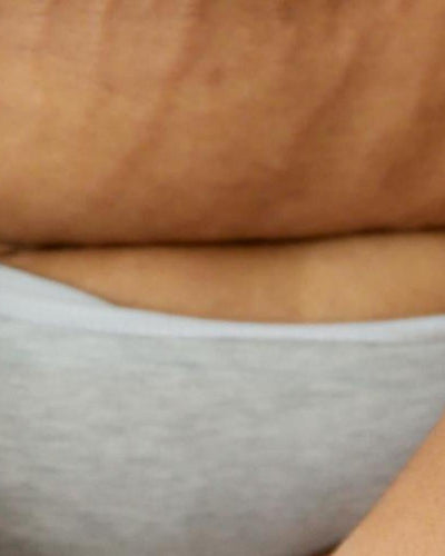 Rééduquer votre périnée efficacement avec la biofeedback