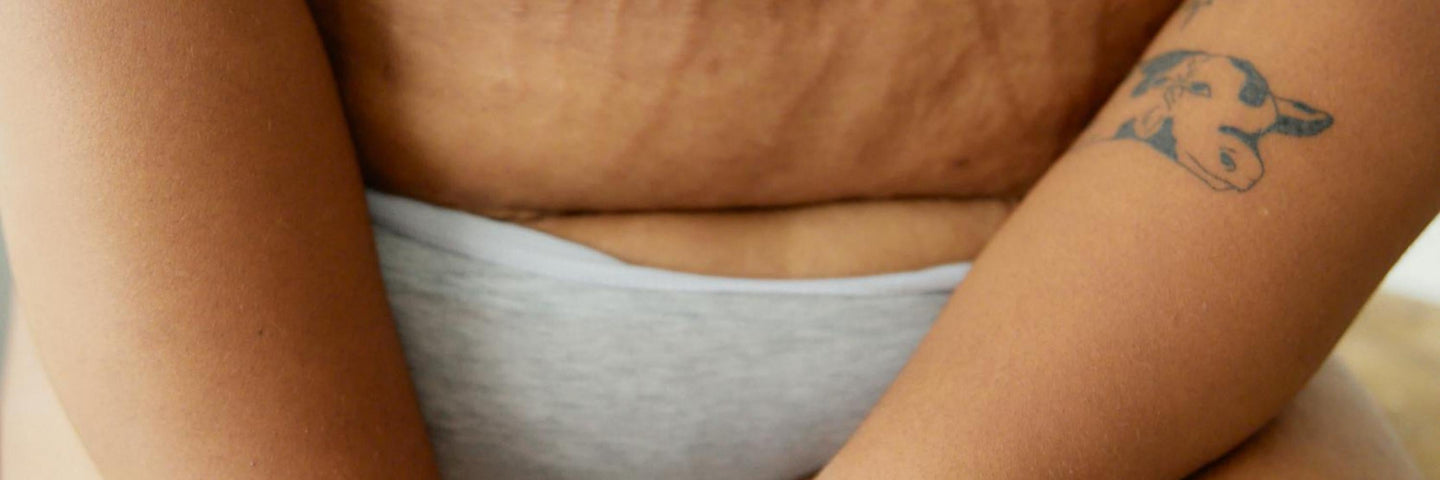 Rééduquer votre périnée efficacement avec la biofeedback