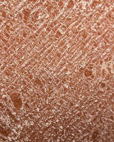 Sécheresse intime pendant la ménopause : Traitements naturels efficaces