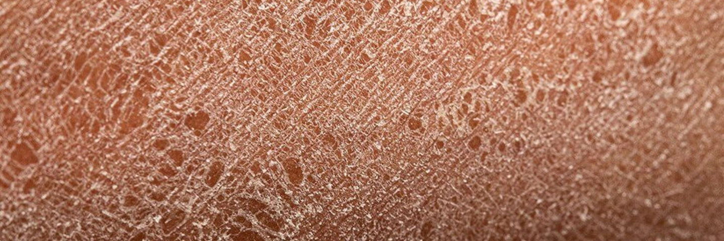 Sécheresse intime pendant la ménopause : Traitements naturels efficaces