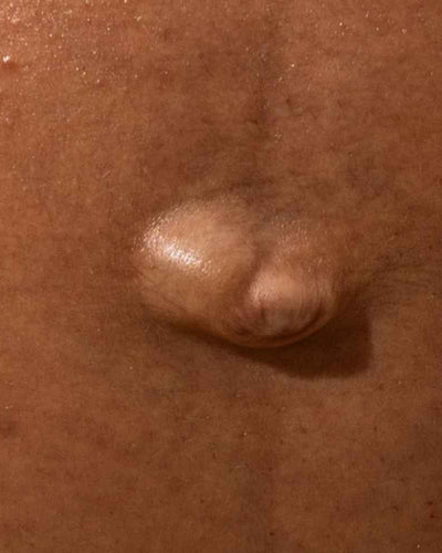 Tout savoir sur les soins après accouchement à prodiguer à la maman