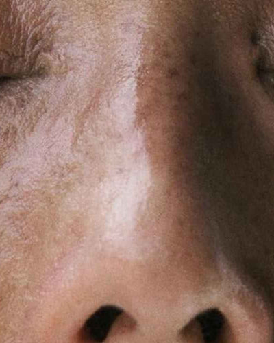 Les 6 principaux symptomes de la Ménopause