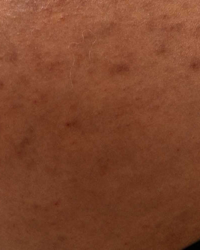 Que faut-il faire pour bien préparer sa valise de maternité ?