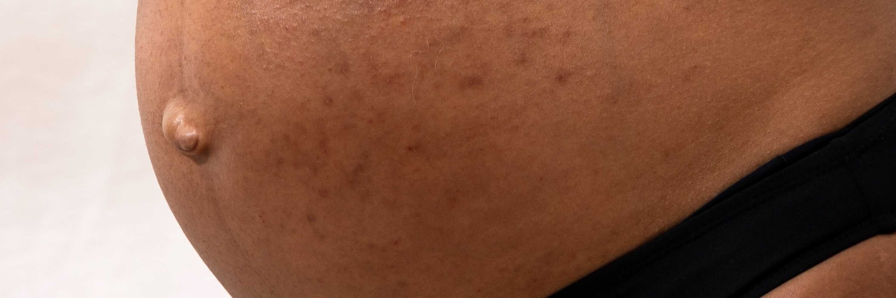 Que faut-il faire pour bien préparer sa valise de maternité ?