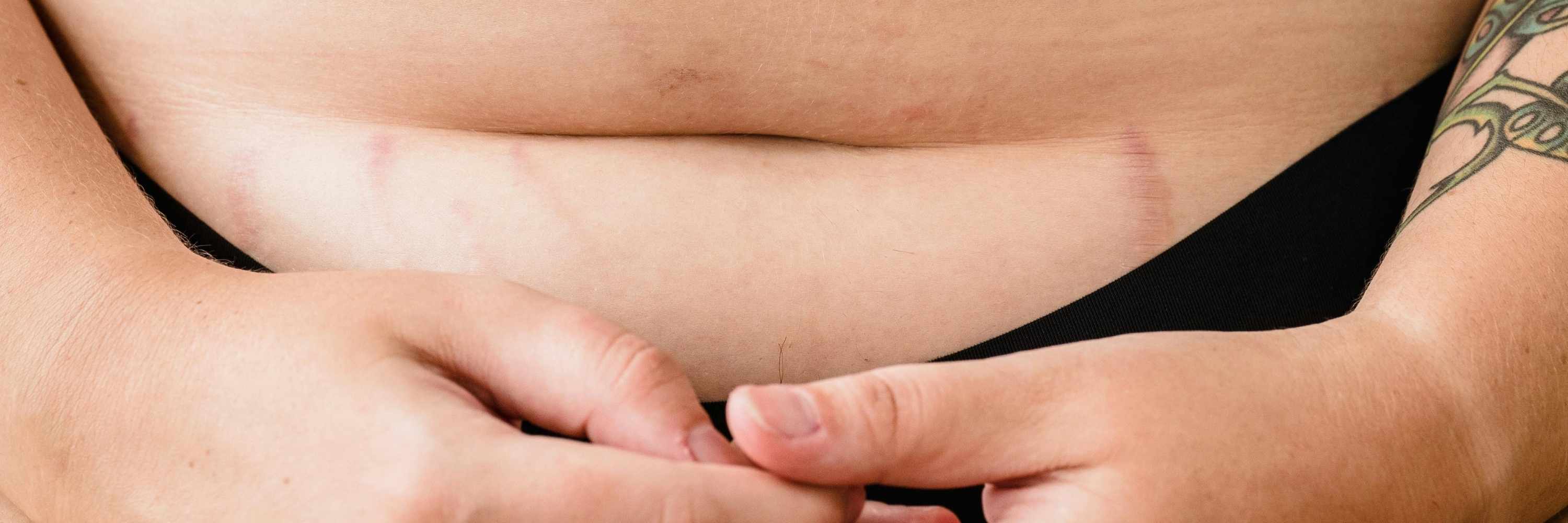 Retrouver un ventre plat après l’accouchement