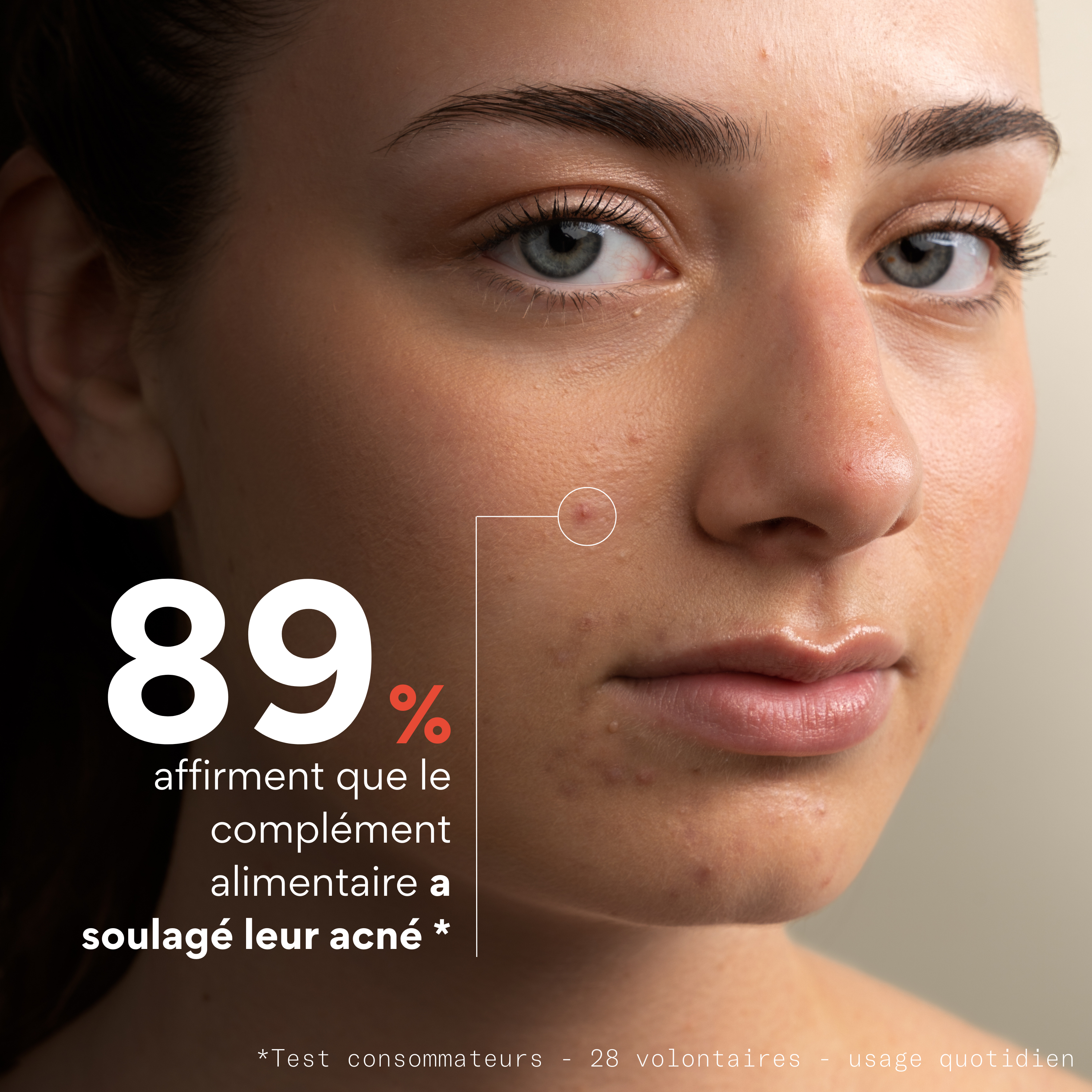 Complément alimentaire anti-boutons - Skin & Out