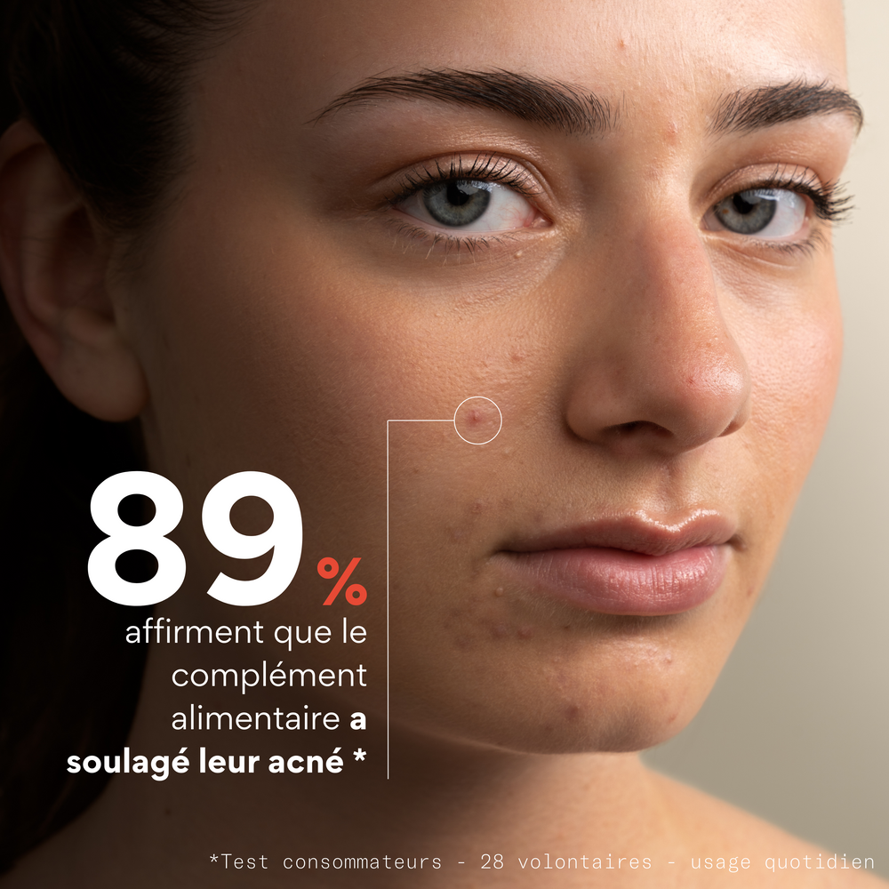Complément alimentaire anti-boutons - Skin & Out