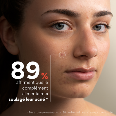 Complément alimentaire anti-boutons - Skin & Out