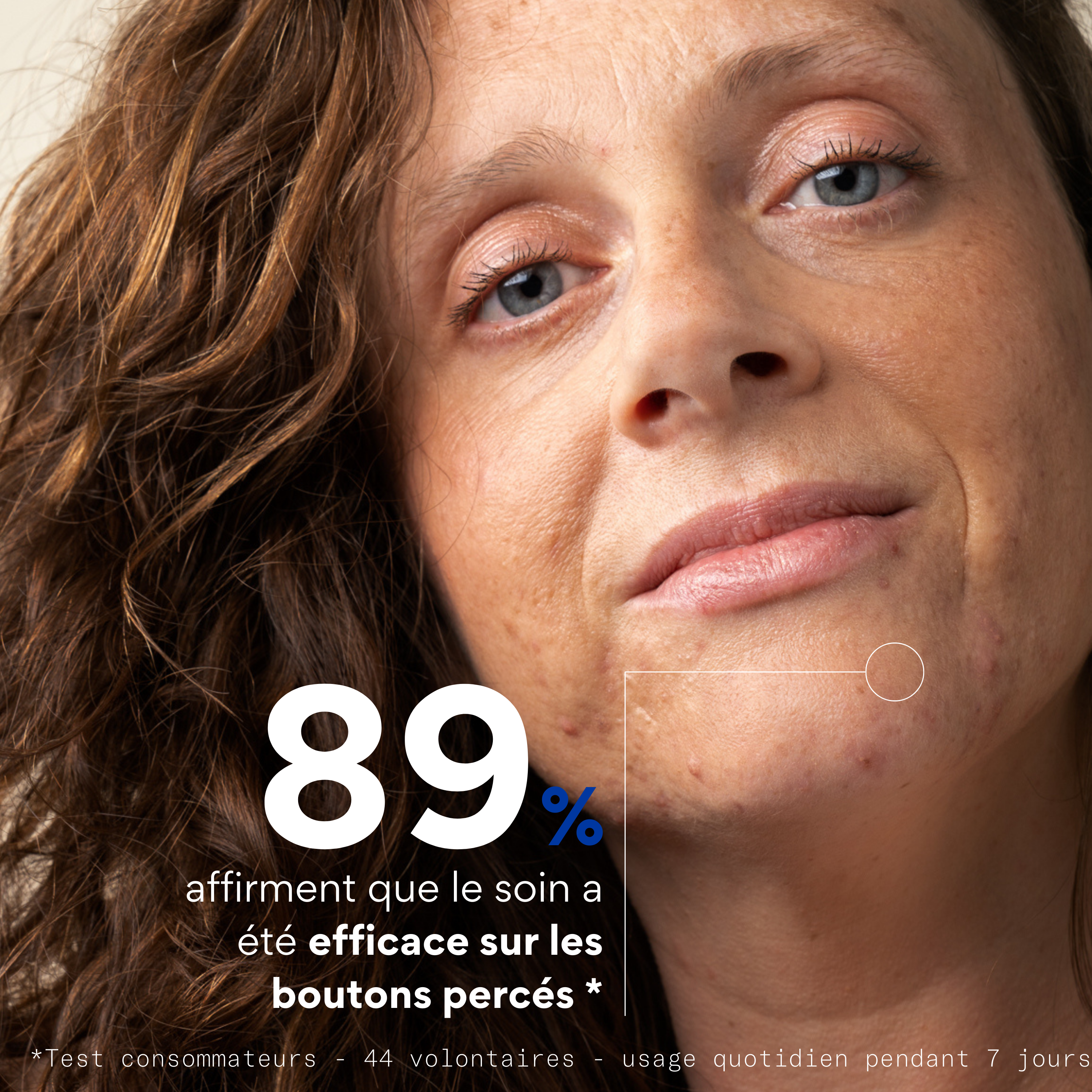 Soin réparateur après perçage de boutons - SKIN & OUT