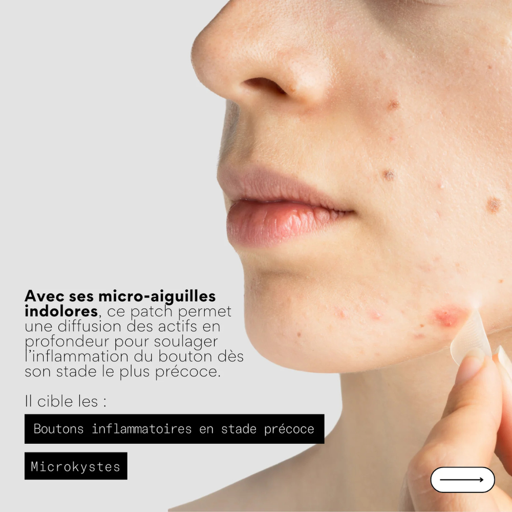 Patchs anti boutons micro aiguilles x9 - SKIN & OUT