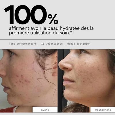 Crème hydratante pour les imperfections  - SKIN & OUT