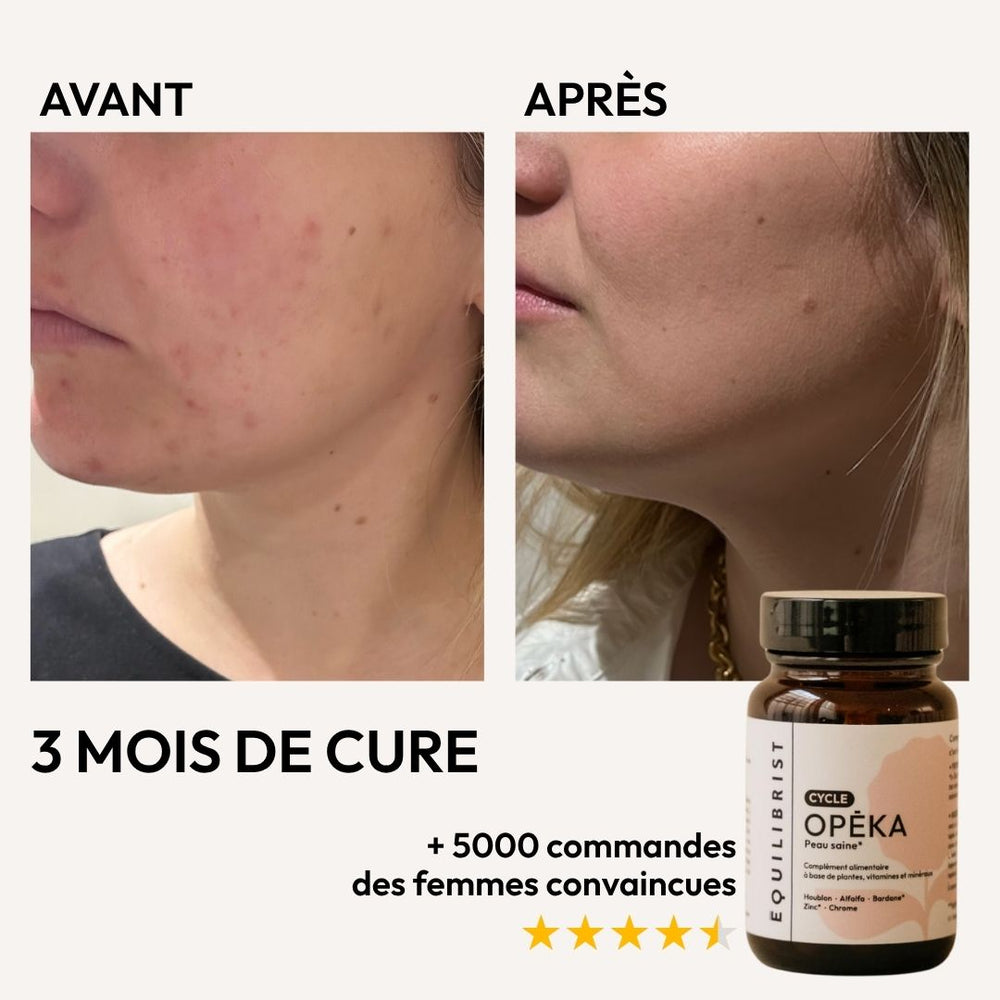 Opeka Equilibrist, des compléments alimentaires pour une peau plus saine, sans boutons et un meilleur équilibre hormonal