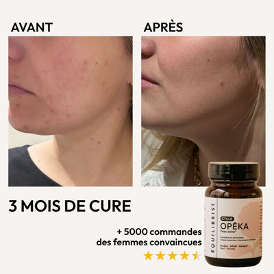 Opeka Equilibrist, des compléments alimentaires pour une peau plus saine, sans boutons et un meilleur équilibre hormonal