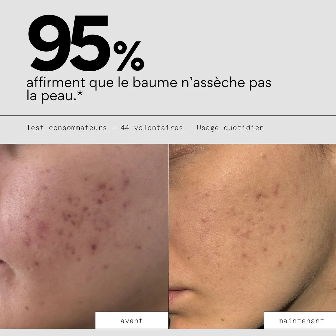 Baume démaquillant - SKIN & OUT