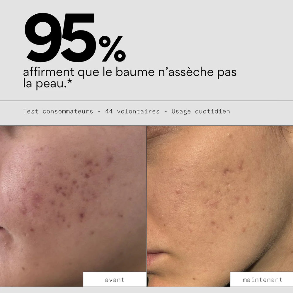 Baume démaquillant - SKIN & OUT