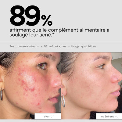 Complément alimentaire cure anti-imperfections - SKIN & OUT
