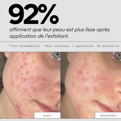 masque-exfoliant-peel-out-skin_out-gapianne-5