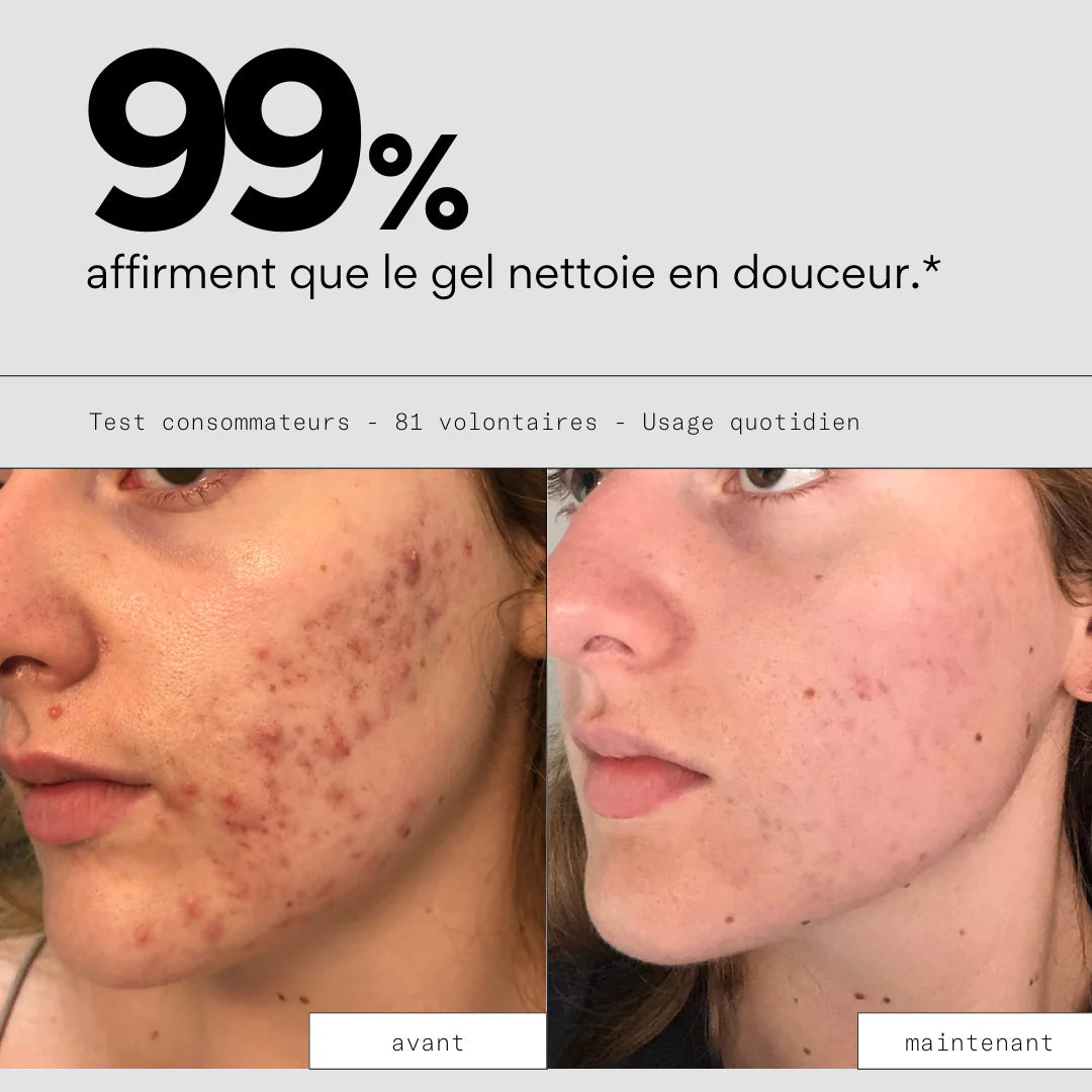Nettoyant visage purificateur peau - SKIN & OUT