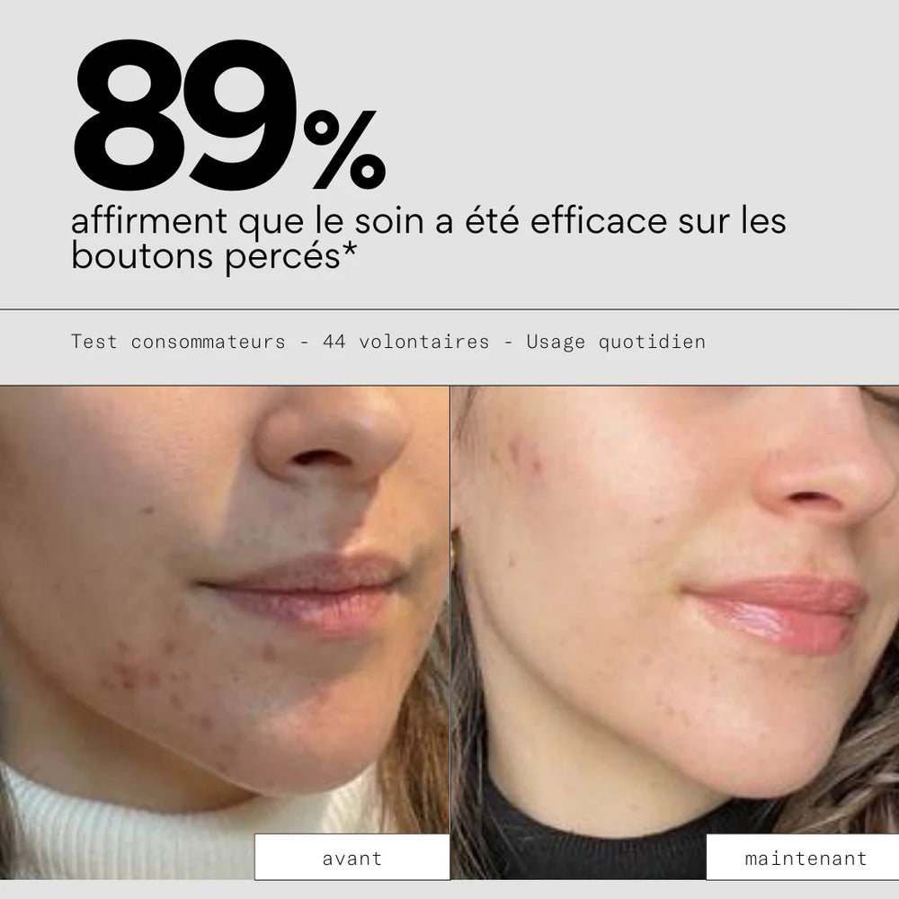 Soin réparateur après perçage de boutons - SKIN & OUT