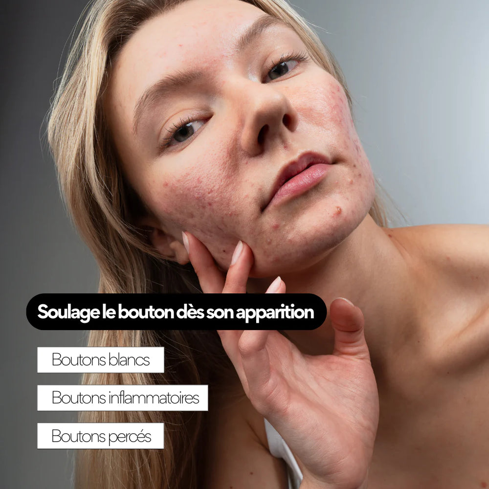Soin anti-boutons aux prébiotiques - SKIN & OUT