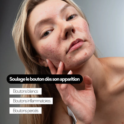 Soin anti-boutons aux prébiotiques - SKIN & OUT